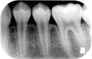 2805_6358128-300x192