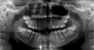 e1c69715eba4659c79ac53e15bb96761-300x160